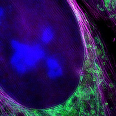 Diese Aufnahme des neuen Mikroskops zeigt eine lebende Knochenkrebszelle mit Zellkern (blau), Mitochondrien (grün) und Zytoskelett (magenta). Foto: Universität Bielefeld/W. Hübner