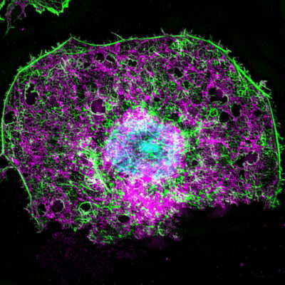 A high-resolution, microscopic fluorescent image of an endothelial liver cell.