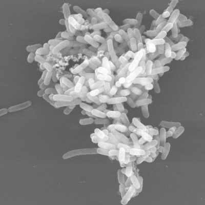 Mehrzelliges/ vielzelliges Cluster der Bakterienart Escherichia col